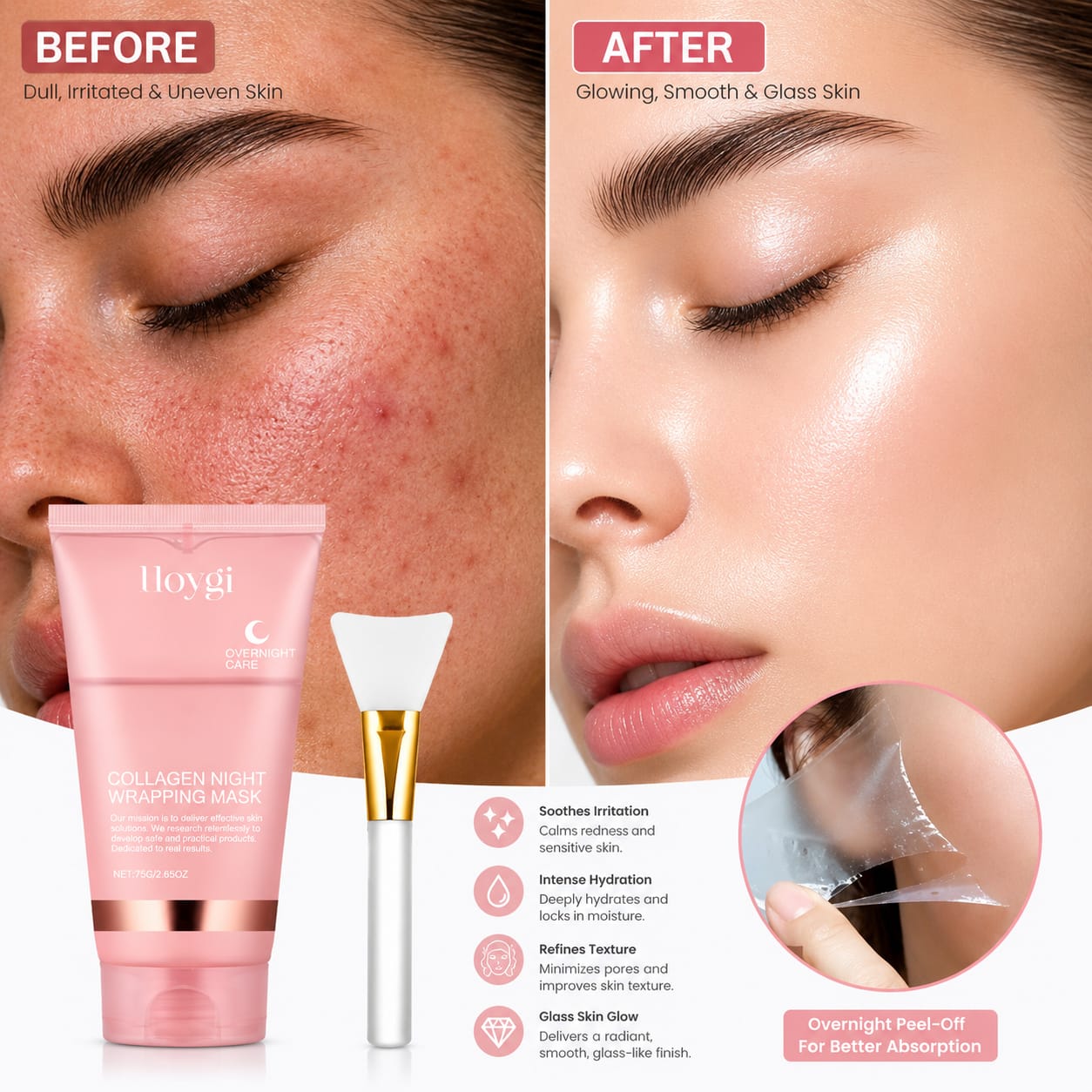Before and after 1